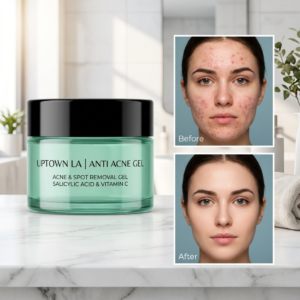 Acne Cream 2